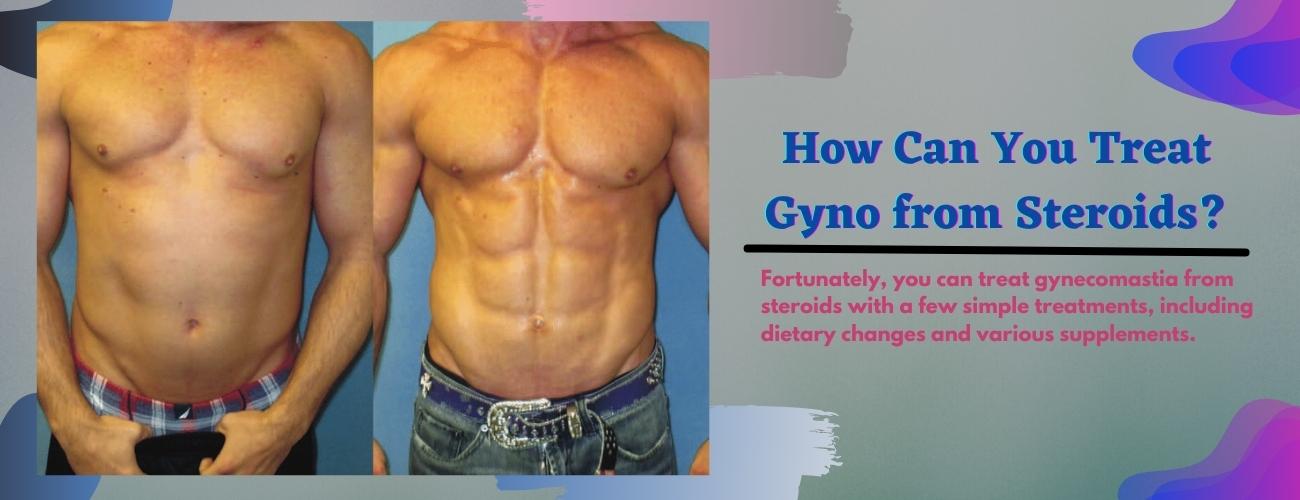How Can You Treat Gyno from Steroidit?